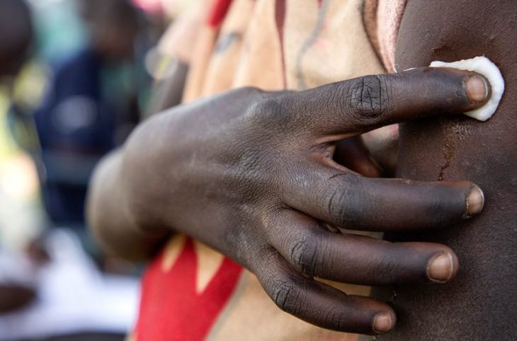 Papillomavirus : quels sont les traitements adéquats ?