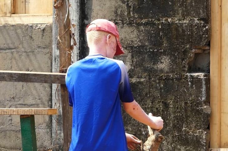 Centrafrique : Josué et Elysée, deux frères albinos, appellent à l’aide pour reprendre les études