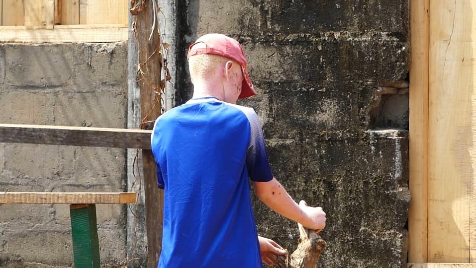 Centrafrique : Josué et Elysée, deux frères albinos, appellent à l’aide pour reprendre les études