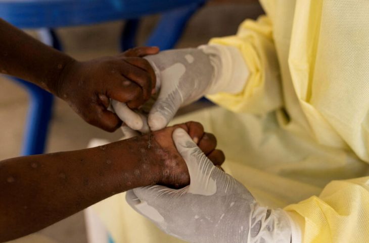 Centrafrique : l’hôpital de Nola miné par des arriérés de salaire et le manque de médicaments