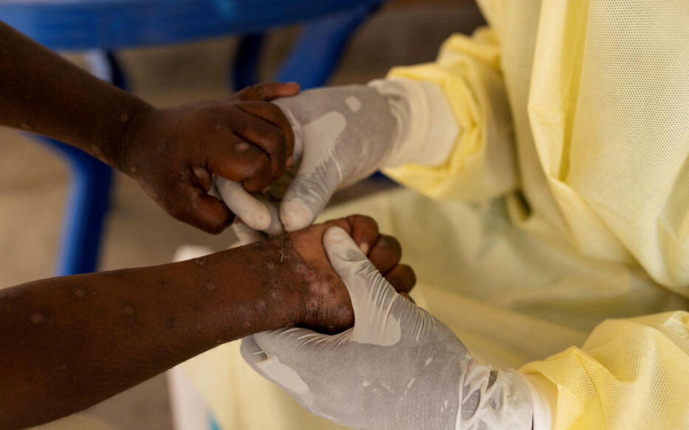 Centrafrique : l’hôpital de Nola miné par des arriérés de salaire et le manque de médicaments