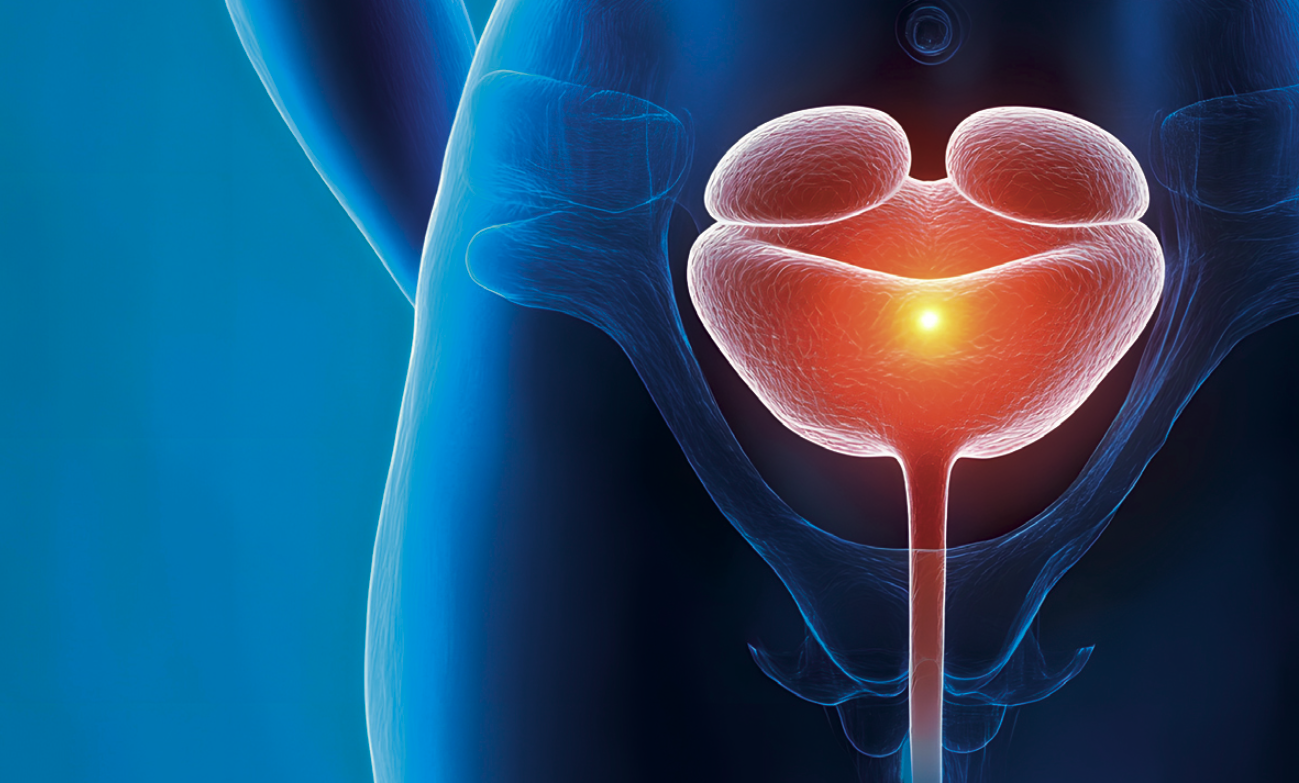 Infections urinaires : environ 30% de femmes touchées en Centrafrique