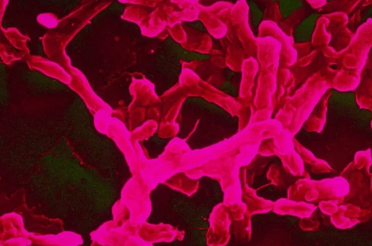 Fièvre typhoïde : comment se soigner et s’en protéger ?