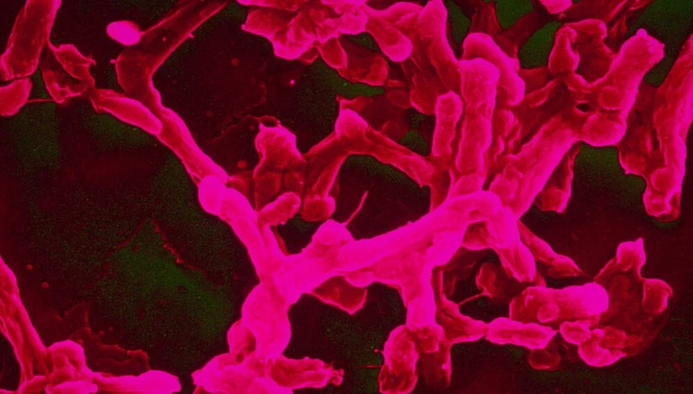 Fièvre typhoïde : comment se soigner et s’en protéger ?