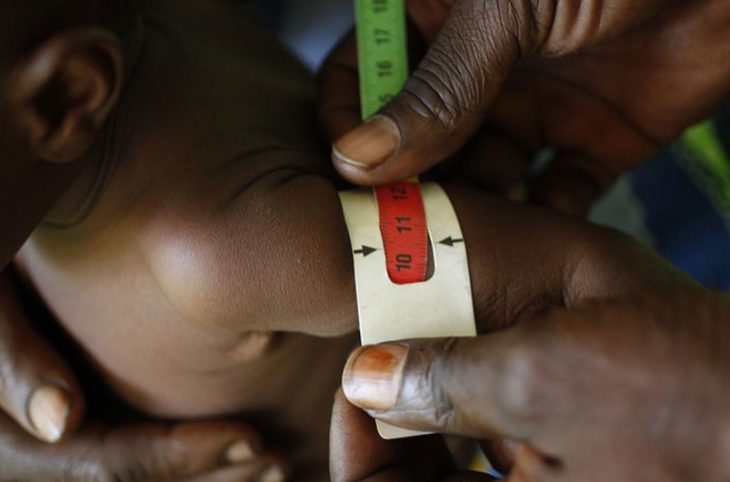 La malnutrition, une maladie qui frappe les enfants en Centrafrique