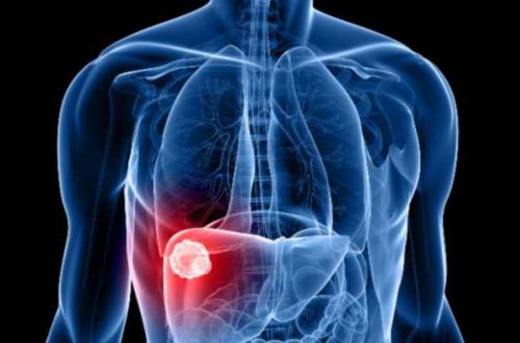 Mag-santé : quelle est l’origine de l’hépatite virale ?