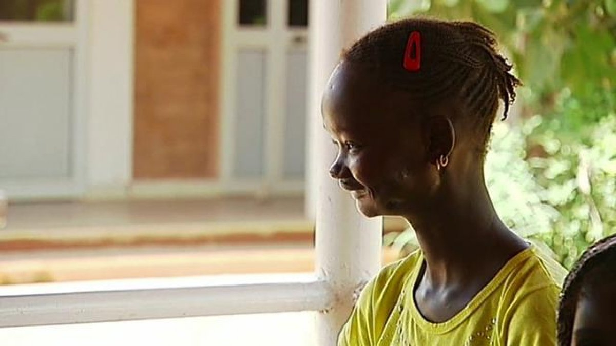 RCA : Lancement d’une grande campagne de  réparation des déformations faciales