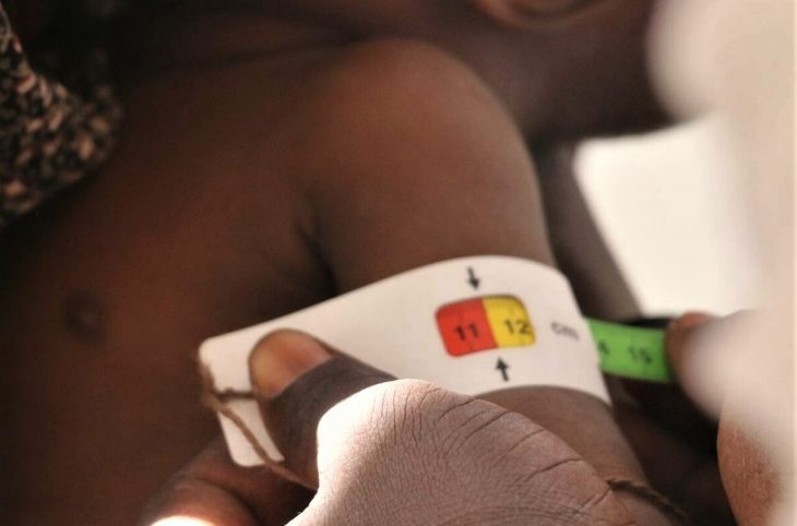 Que faire pour éviter la malnutrition ?