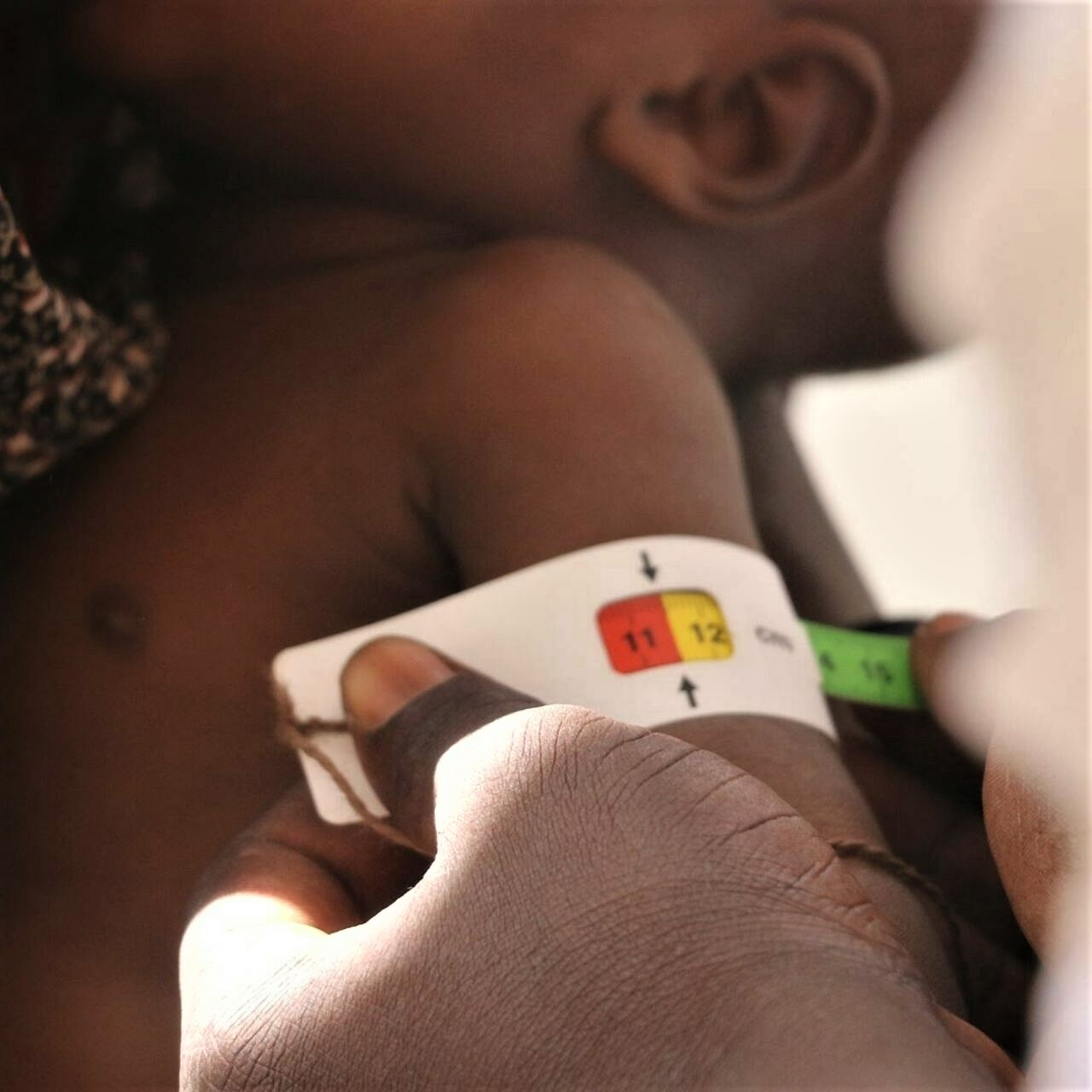Que faire pour éviter la malnutrition ?