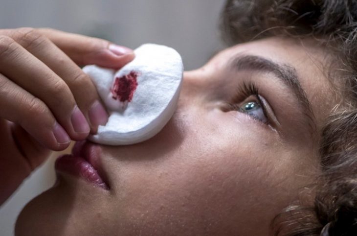 Le saignement nasal, quelles sont les causes ?