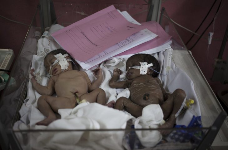 Bangui : Un enfant jeté dans la fausse sceptique a eu la vie sauve suite à une intervention des personnes de bonne volonté